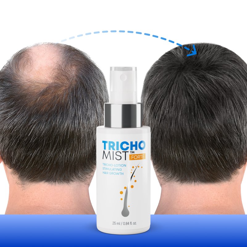 Trichomist forte | trichomist forte - Odkryj Się w Czasie: Efektywna Metoda Lecznicza Trichomist Forte